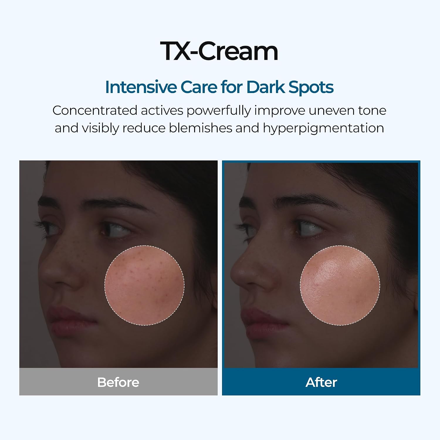 Advanced TX Tone Correcting Cream