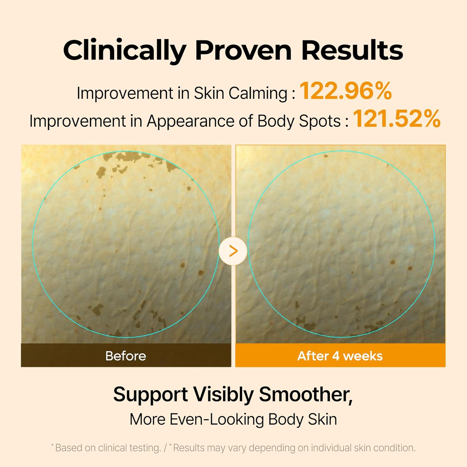 Kojic Acid Turmeric Body Cream
