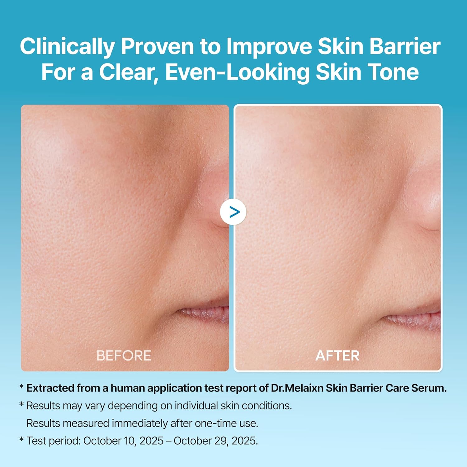 Peel Shot Exfoliating TX Serum 80ml